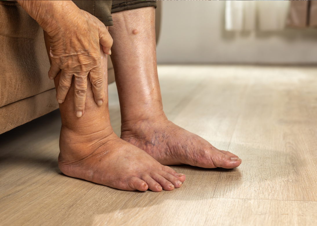 Diabetic foot care consultation